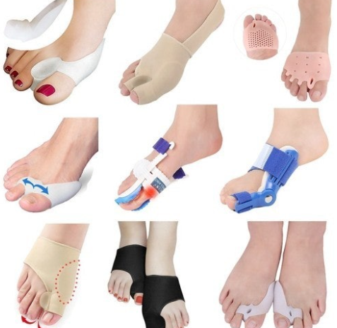 무지외반증&amp;#44; 여름철 신발이 발 건강에 미치는 영향 관련 이미지