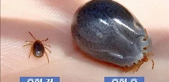 진드기 물린자국 대처법 참진드기 빨간 진드기 증상 확인_11