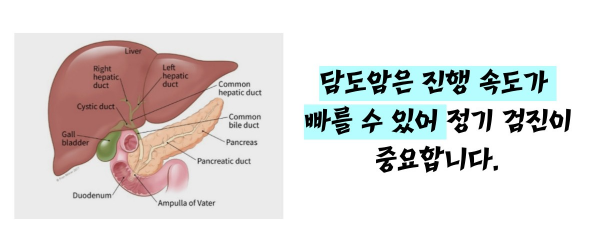 담도암 이란 / 담도암 증상
