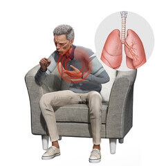 결핵 재발 내성결핵 예방접종 좁쌀결핵