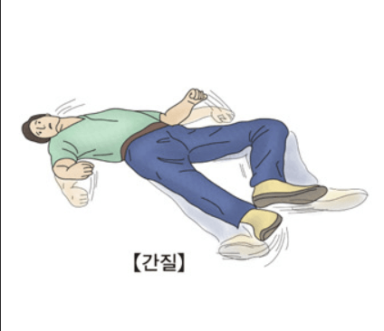 간질