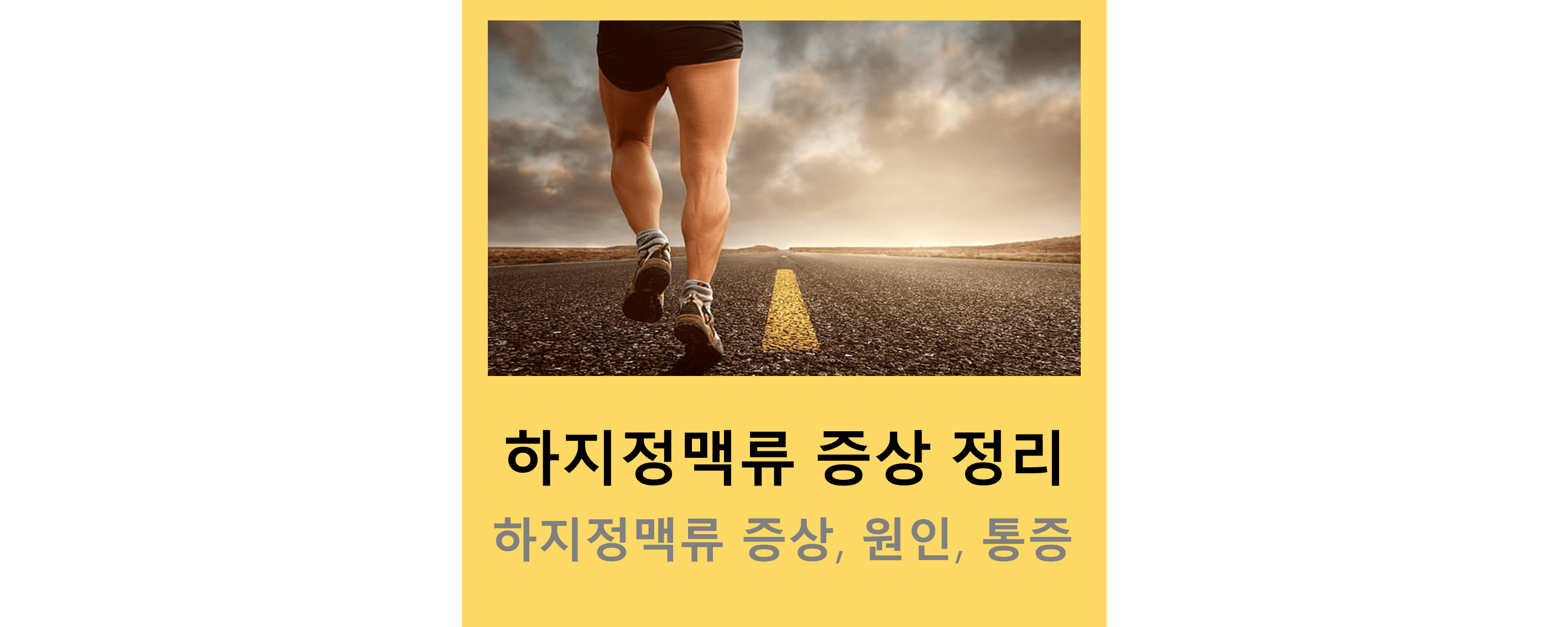 하지정맥류