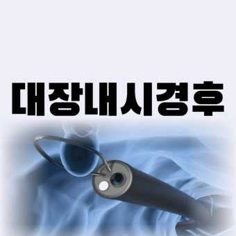 대장 내시경 후 음주