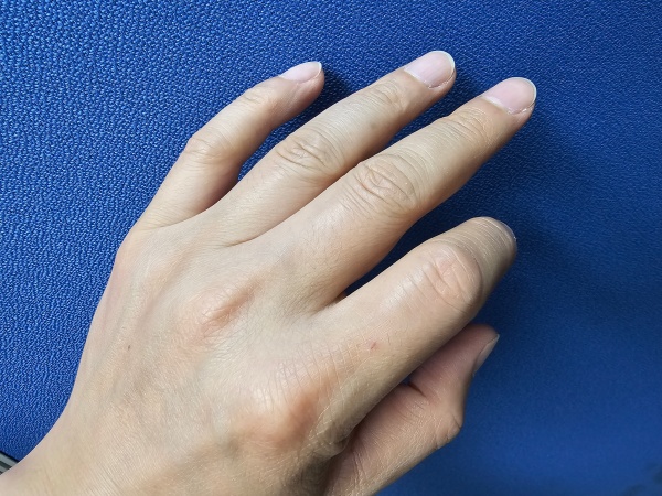 펴져있는-손가락