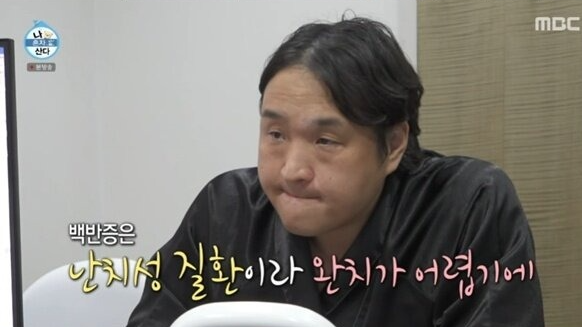 &lsquo;나 혼자 산다&rsquo; 구성환의 백반증 투병 이야기