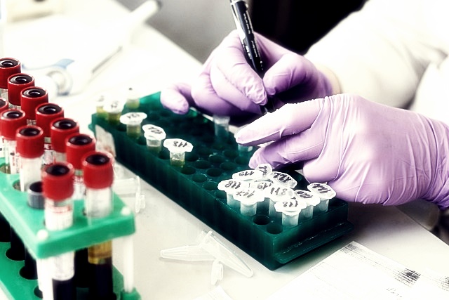 알테오젠 주가분석