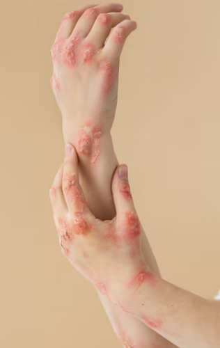 왼쪽 아랫배 통증 33