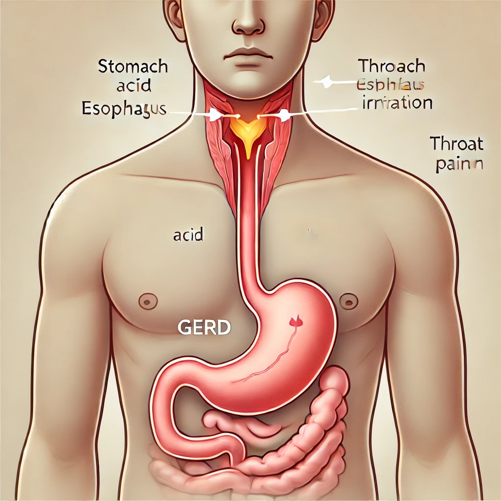 목이 자주 붓고 아픈 이유 원인과 대처법 - 4. 위식도 역류질환(GERD)과 목 통증