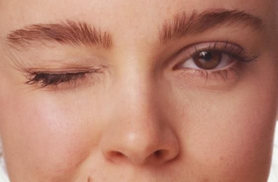 눈꺼풀이 떨리는 증상