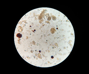 르네상스 시대의 국민 건강: 현대 의학의 씨앗이 뿌려진 시대4