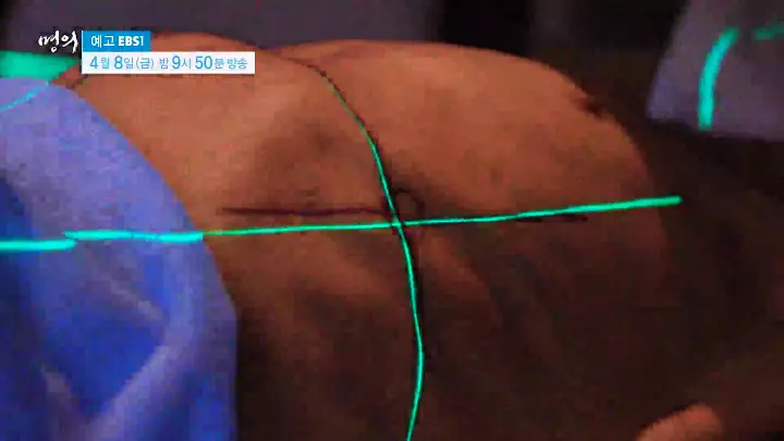 명의 간이식 간암 알프스수술 간경변 간암 간경화 간염 바이러스 전문의 서경석 김기훈 임영석 교수 진료 예약 소개