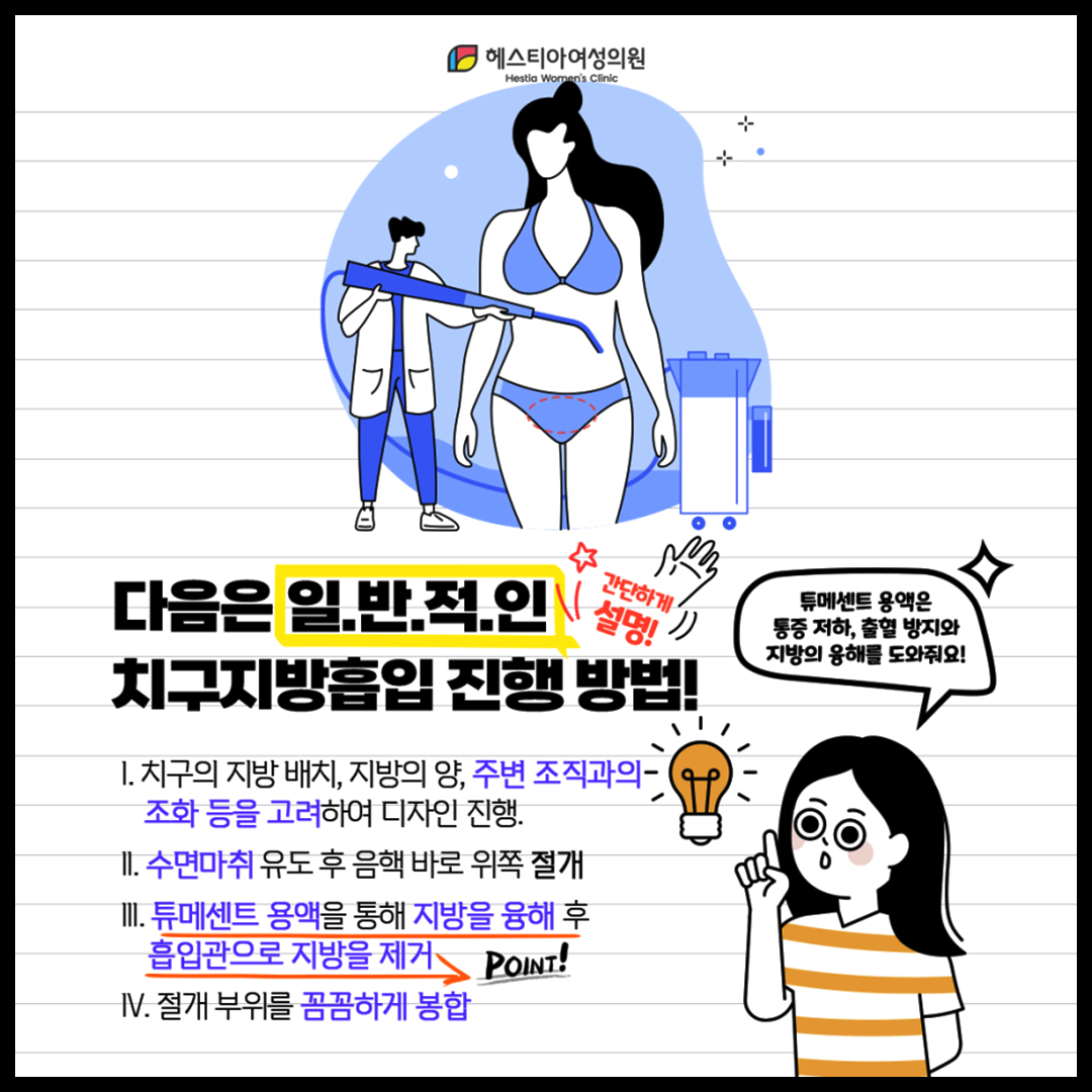 일반적인 치구지방흡입 진행방법