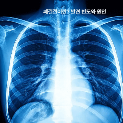 폐결절 발견 시 추가검사·치료 과정 (2025)|조직검사·추적관찰·비용 가이드