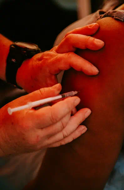 대상포진 초기증상 관련사진26