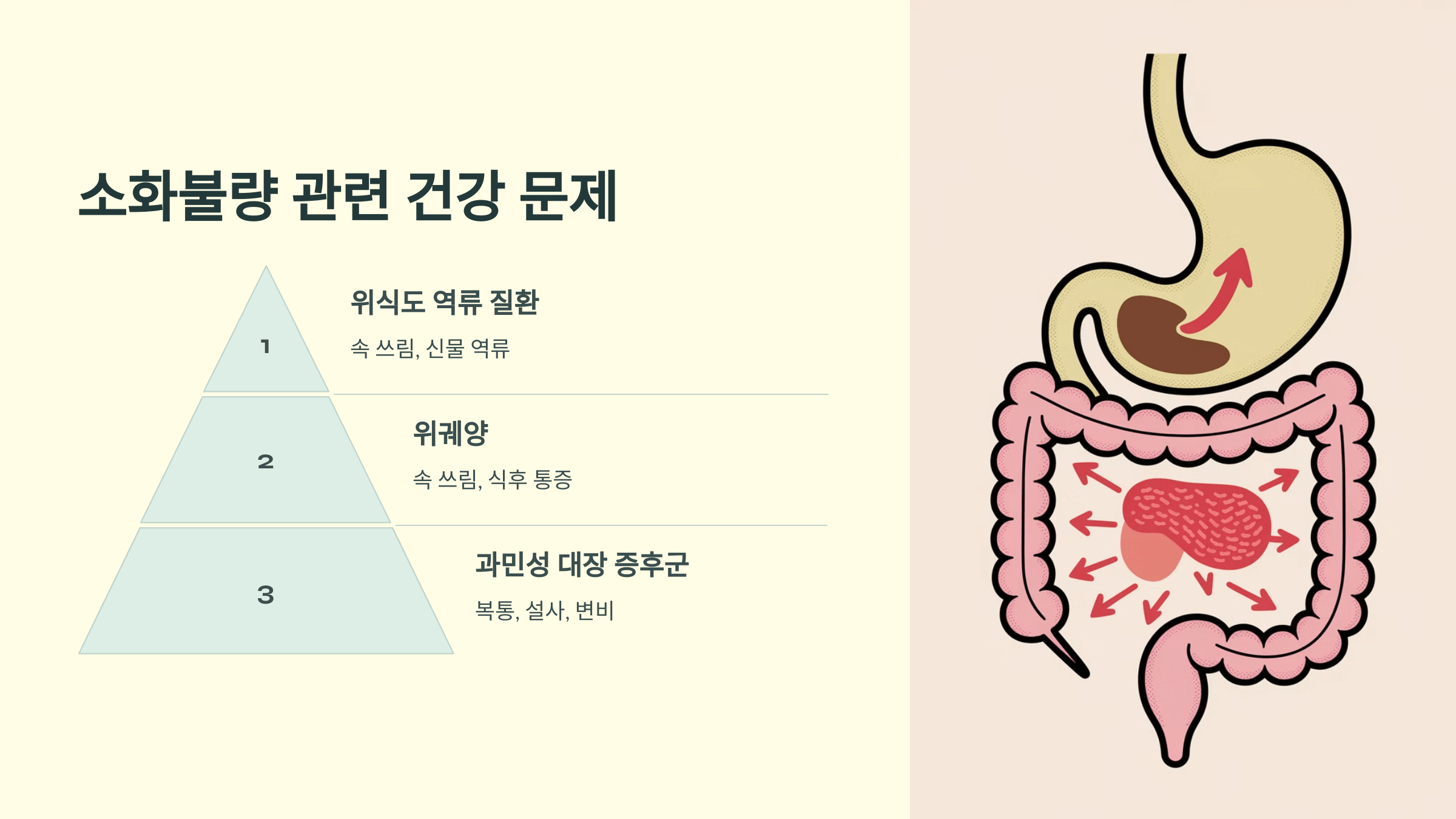 소화불량