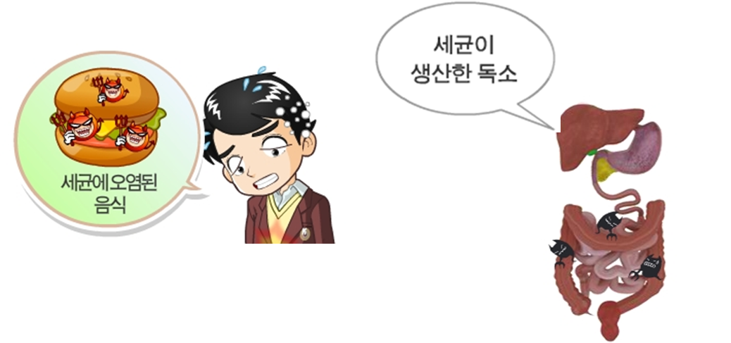 식중독의 유형