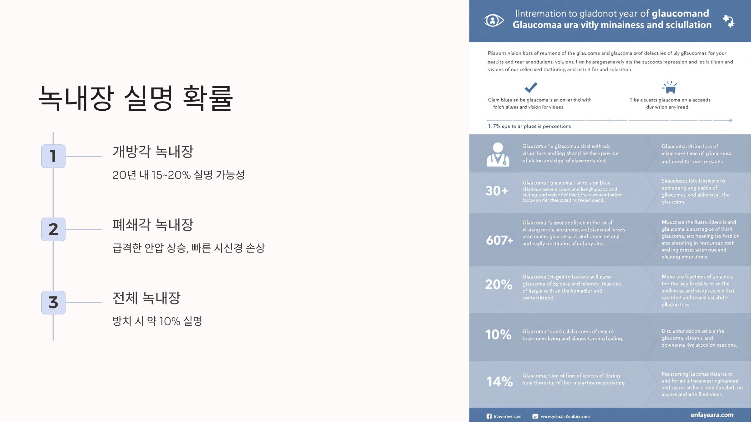 녹내장과 관련된 사진입니다.