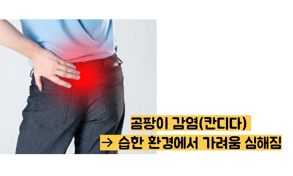 똥꼬가 가려운 이유