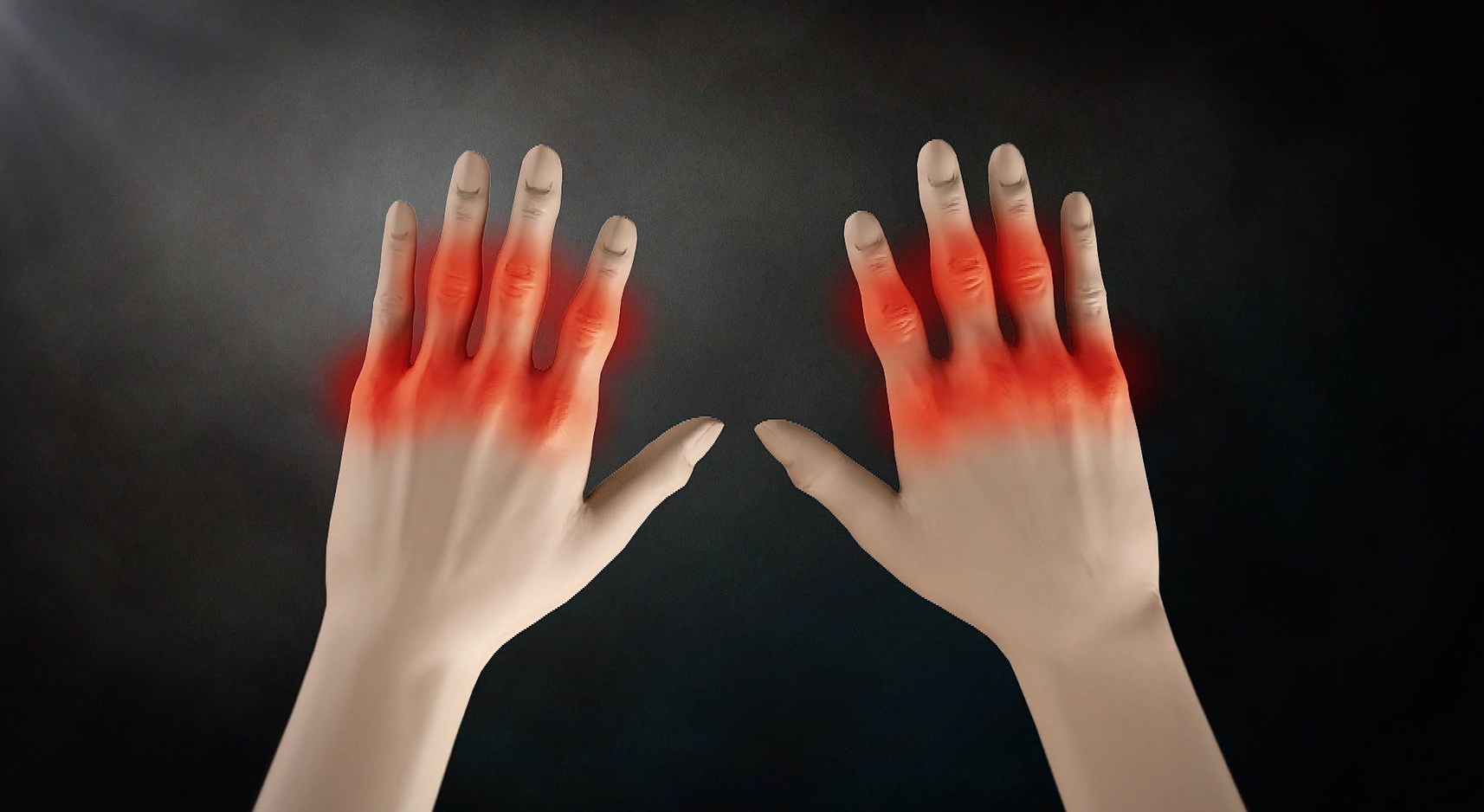 명의 류마티스 관절염