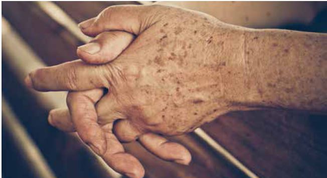 검버섯 없애는 방법