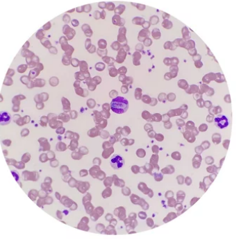 강아지 심장사상충/출처:어도비스톡