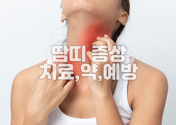 한여성이 땀띠로 인한 가려움으로 목부분를 간질고 있다