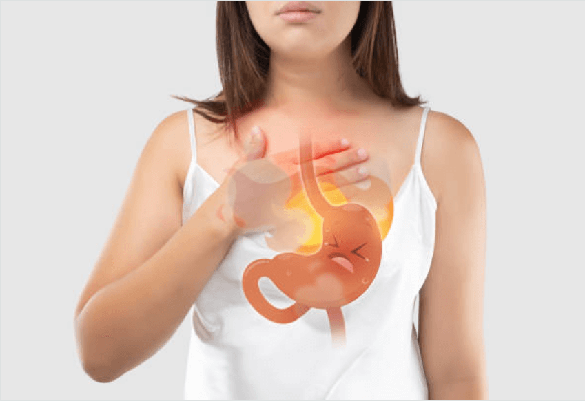 역류성-식도염-증상