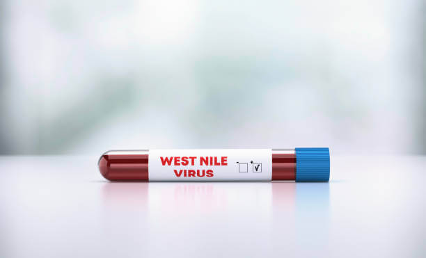 웨스트나일 바이러스 감염