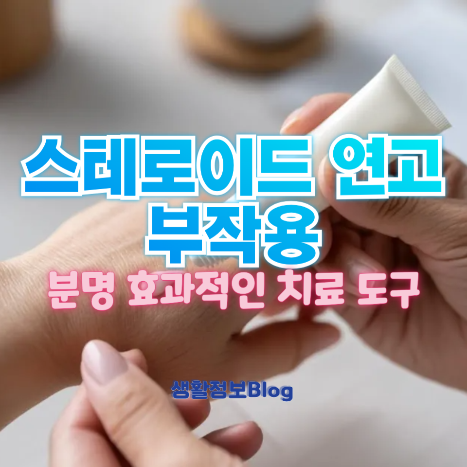 스테로이드 연고 부작용