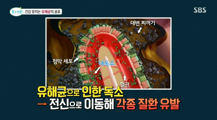 건강 망치는 유해균이 공포, 대장암 크론병 관절염 치매