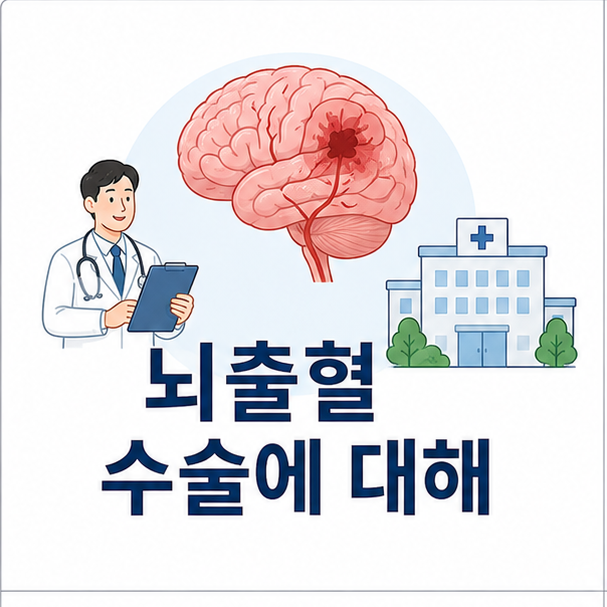 뇌와 의료진, 병원 아이콘으로 뇌출혈 수술을 설명하는 의료 정보 이미지