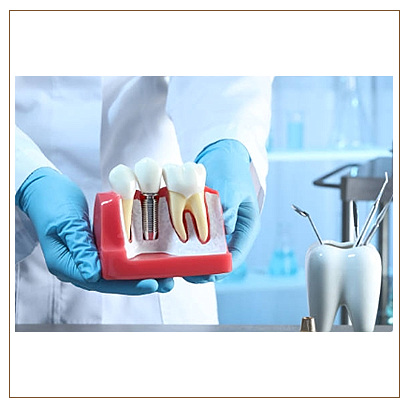 어금니 임플란트 비용