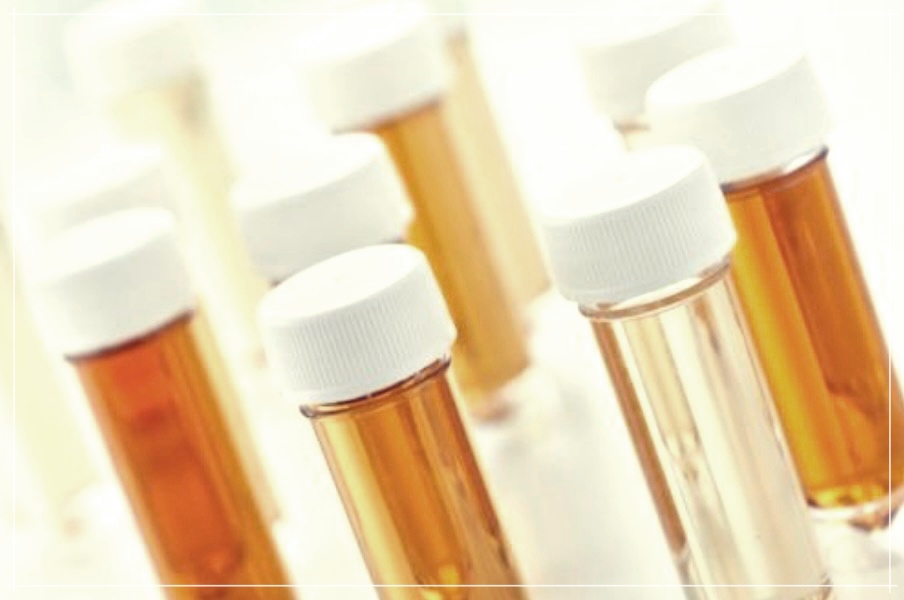 주황색 소변에서 노란색 소변까지: 색깔로 알아보는 건강체크