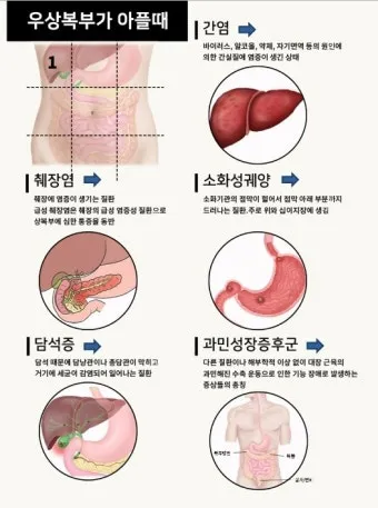 배를 콕콕 찌르는 통증의 8가지 원인 하는법 알아보기로 정리_2