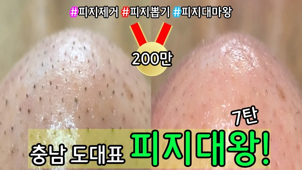 남자 얼굴 피지 제거 화장품 꿀템_7