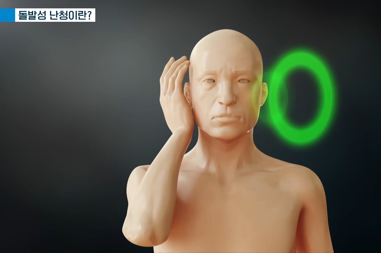 명의-돌발성난청-임기정-교수