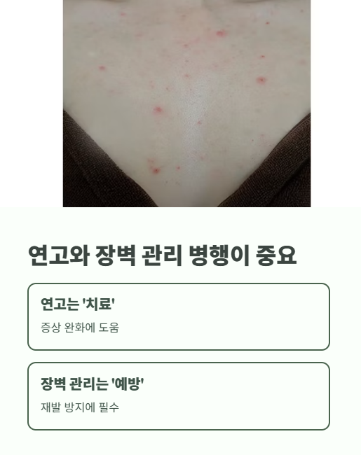 연고와 장벽 관리 병행이 중요