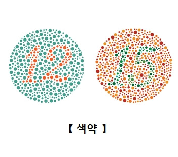 색맹 원인부터 증상·치료까지 한눈에