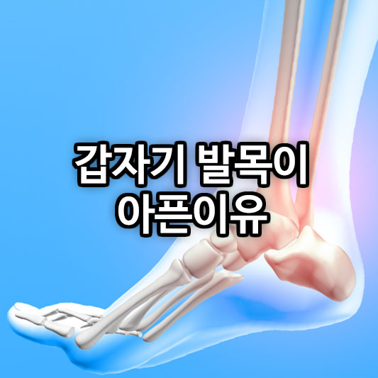갑자기 발목이 아픈이유