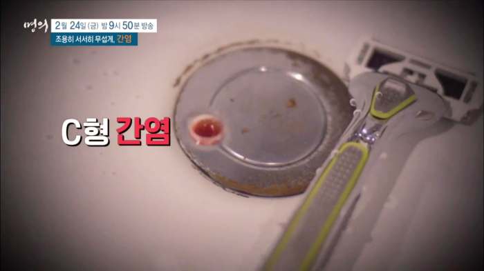 명의 A형 B형 C형 간염 증상 예방접종 원인 전염 항체 검사 비용 방법