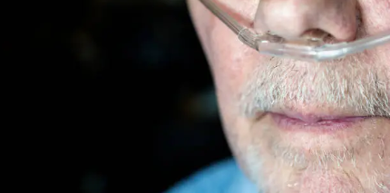 특발성 폐섬유화