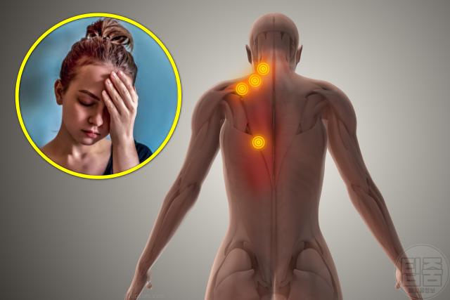 근육 뭉침 원인 스트레스 긴장