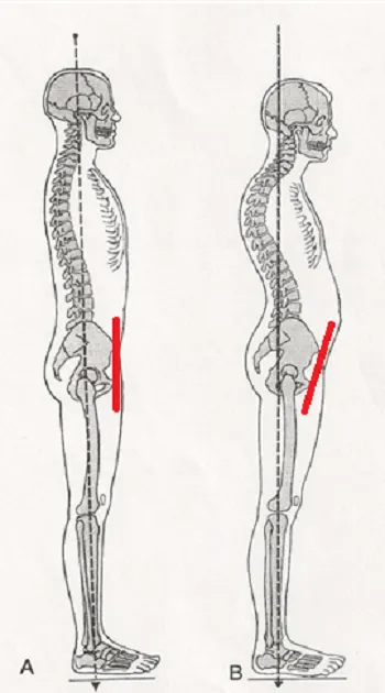 좋은자세전방경사자세