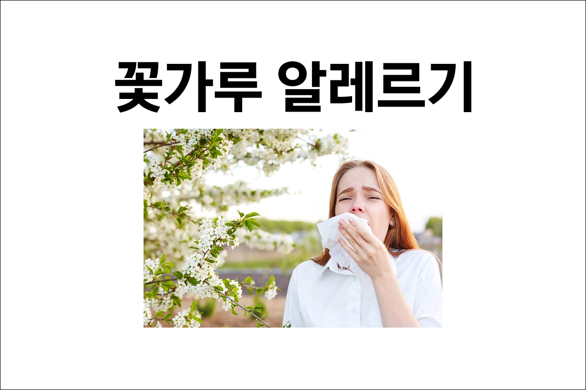 꽃가루 알레르기 치료 원인 증상 예방