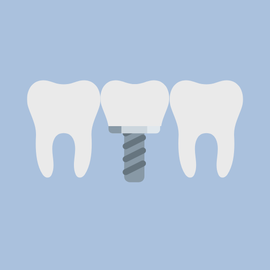 임플란트-이미지-예시