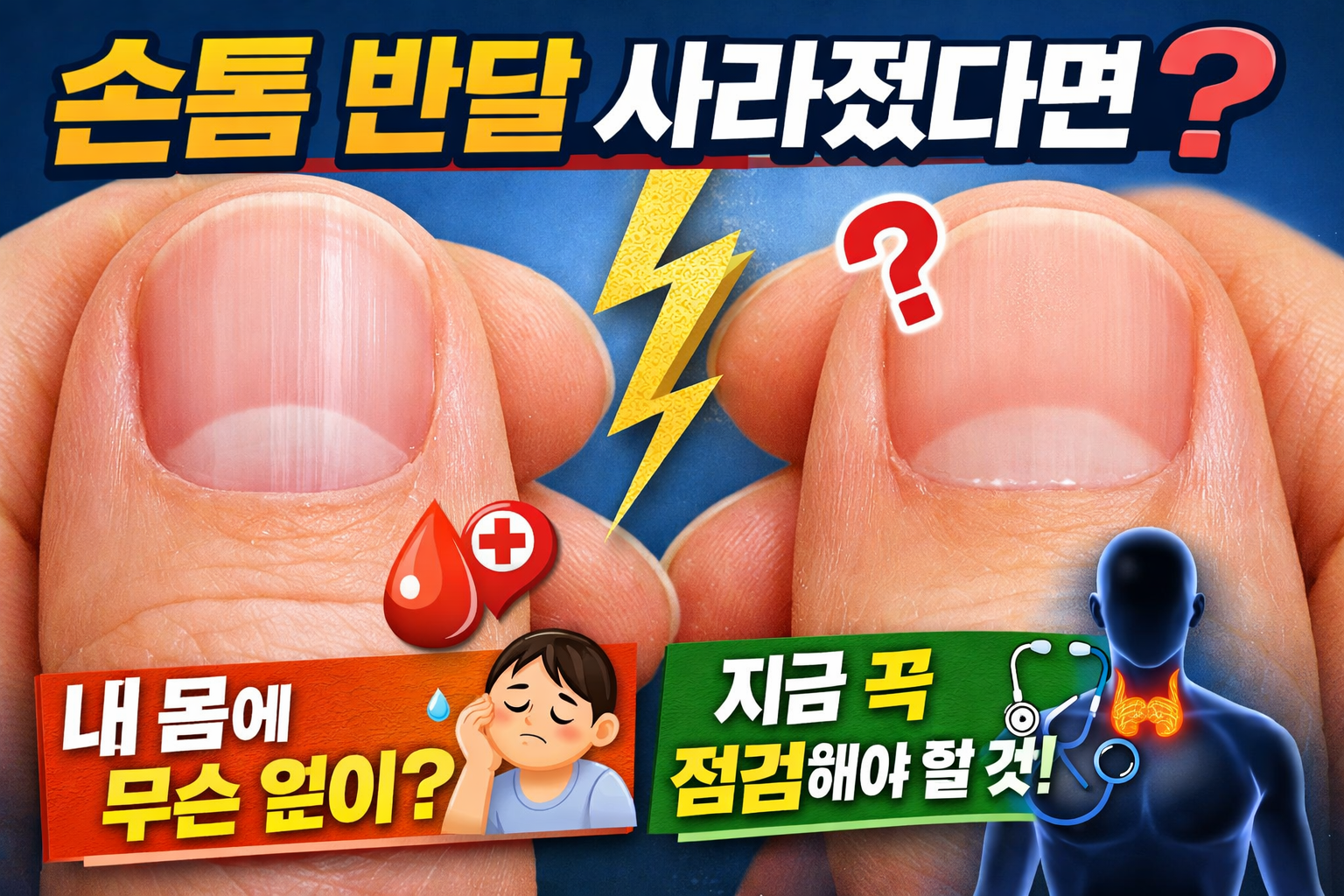 손톱 반달 사라졌다면? 지금 내 몸에 생긴 변화