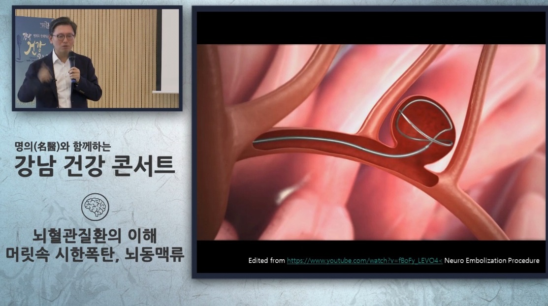 명의-뇌동맥류-김용배-교수-신경외과