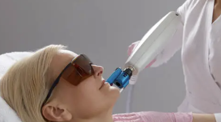 사마귀 제거방법 20