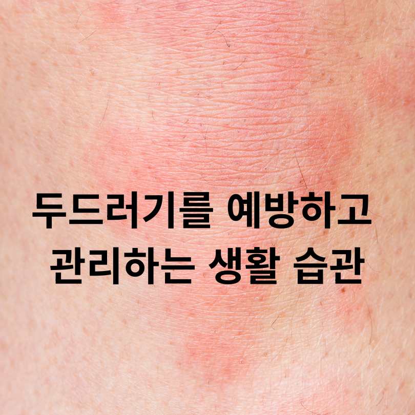 두드러기 간지러움 심할 때 해결방법과 원인