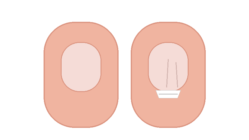 손톱이 갈라지고 잘 깨지는 이유(취약손톱) 총정리: 건조&middot;세제&middot;시술 손상부터 질환 감별까지
